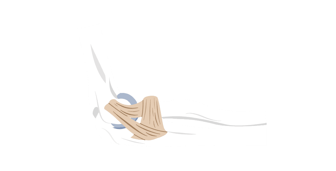 Ліктьовий суглоб